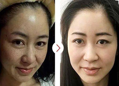 女子因脱发，30岁被误认为奶奶——一则关于外貌与年龄的误解